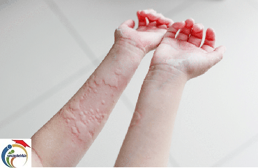 skin itching