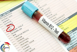 Vitamin B12 4